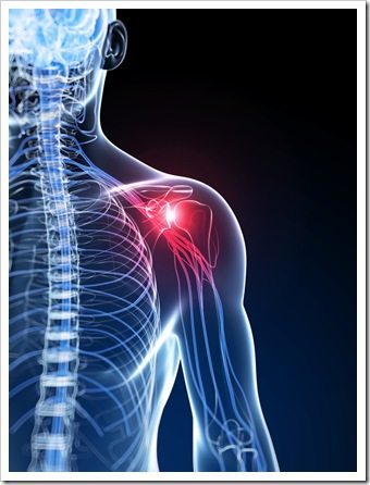 Shoulder Pain Amarillo TX Rotator Cuff Syndrome