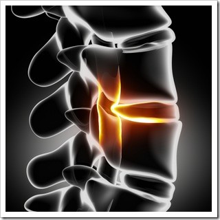 Slipped Disc Amarillo TX